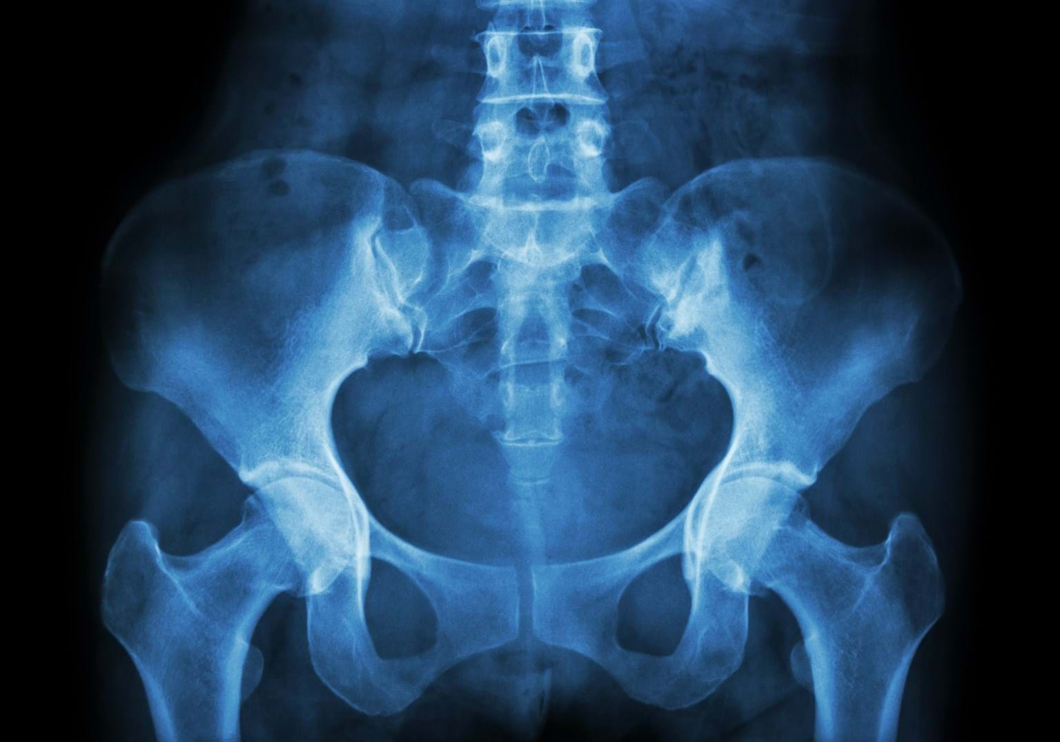 pelvic-pain